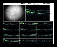 Radial Lines OD.jpg